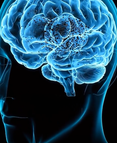 Brain Health Diagram